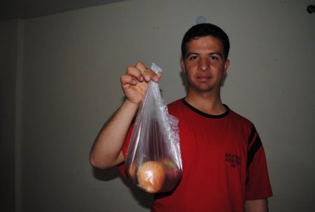 Elma Görünce Elektrik Çarpmışa Dönüyor