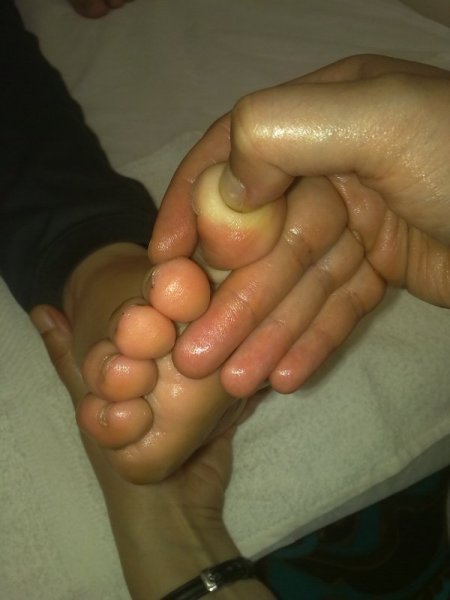 En eski tedavi yöntemlerinden refleksoloji engellilere umut oldu