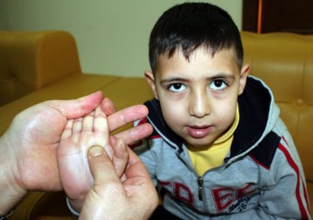 Epilepsi hastası el ve ayak masajıyla bayılma nöbetlerinden kurtuldu