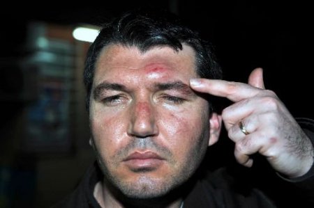 Gazeteci Saldırıya Uğrayıp Darp Edildi