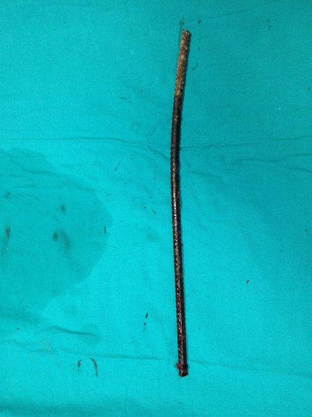 Göğsünü delip geçen demirle hastaneye kaldırıldı