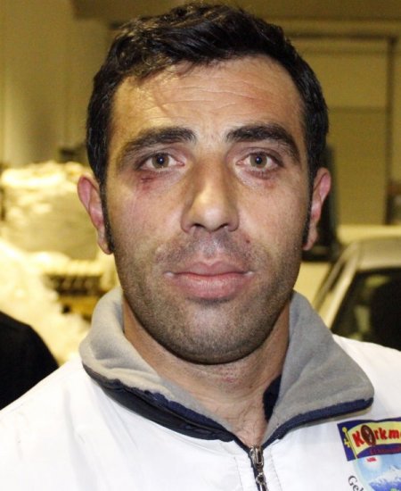 Göz Çukurlarıyla 1 Ton 200 Kiloluk Arabayı Çekti