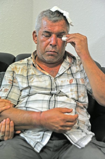 'Gürültü ihbarı yaptı, polisin hışmına uğradı' iddiası