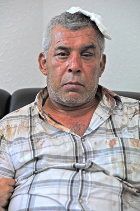 'Gürültü ihbarı yaptı, polisin hışmına uğradı' iddiası