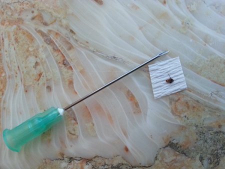 Hakkarililer, endoskopi ile tedavi görmenin sevincini yaşıyor