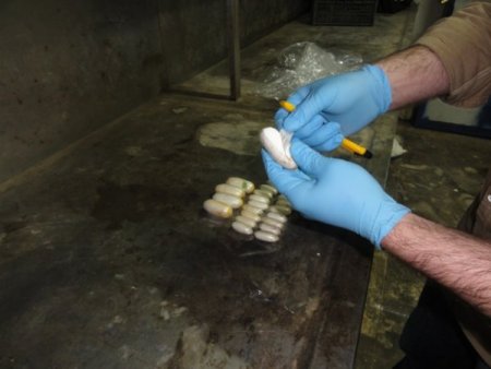 Hamile Kadının Midesinden 975 Gram Kokain Çıktı