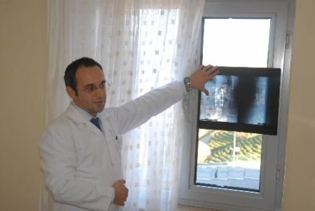 Hamileliğinde Omuru Kırılan Kadın, 11 Saatlik Ameliyatla Sağlığına Kavuştu