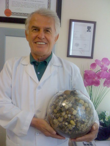 Hastalarının safra keselerinden çıkan taşlarla koleksiyon oluşturdu