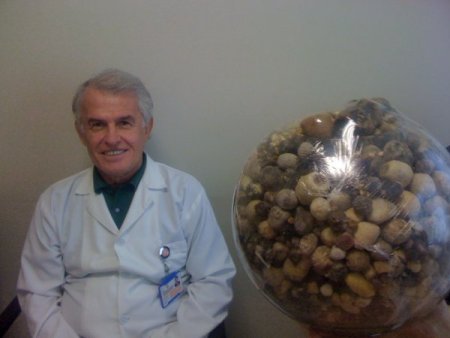 Hastalarının safra keselerinden çıkan taşlarla koleksiyon oluşturdu