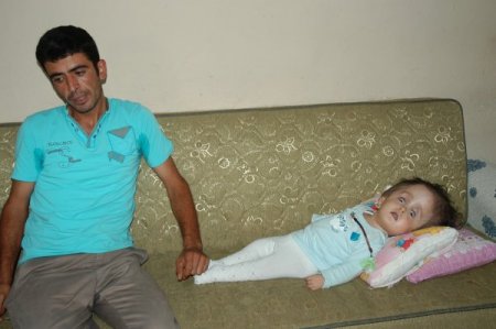 Hidrosefali Hastası Bebek Yardım Bekliyor