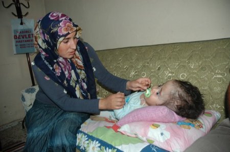 Hidrosefali Hastası Bebek Yardım Bekliyor