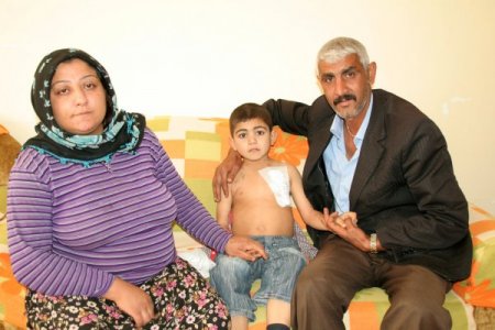 İki böbreği de olmayan minik Hazat nakil bekliyor