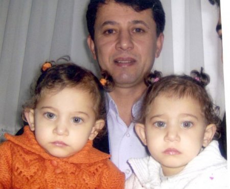 İkizler 5 Aydır Hastanede Kalp Nakli Bekliyor