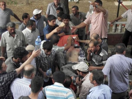 İnşaat İşçisi Ayağını Yük Makarasına Kaptırdı