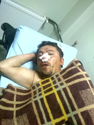 İş üstünde yakalanan trafo hırsızı önce çırılçıplak soyuldu sonra dayak yedi