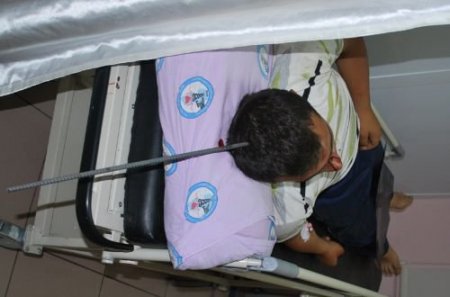 Kafasında Bir Metrelik Şişle Hastaneye Geldi