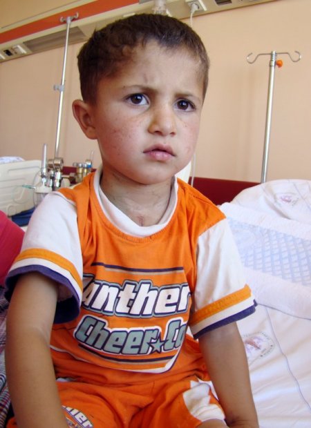 Kalbi Delik Olan Urfalı Mehmet, Konya'da Şifa Buldu