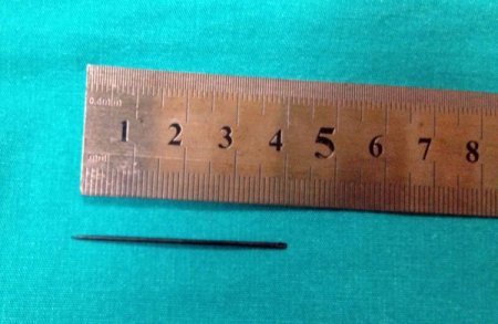 Kalbine saplanan 5 santimetrelik iğne ameliyatla çıkarıldı