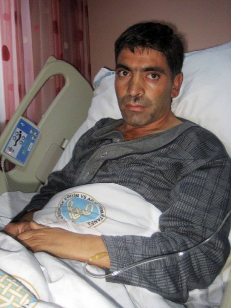 Kalbine saplanan 5 santimetrelik iğne ameliyatla çıkarıldı