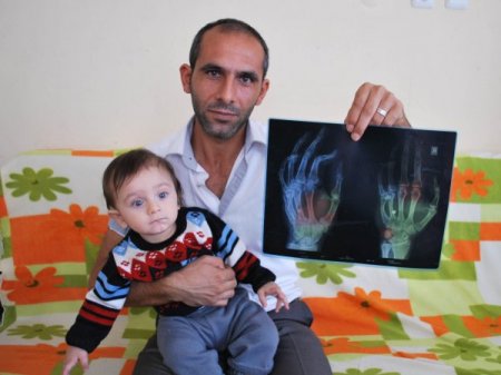 Karakol baskınında yaralanan gaziye fotokopiden üstün hizmet belgesi gönderildi