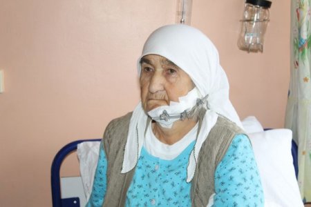 Kastamonu’da ilk çene kırığı ameliyatı gerçekleştirildi