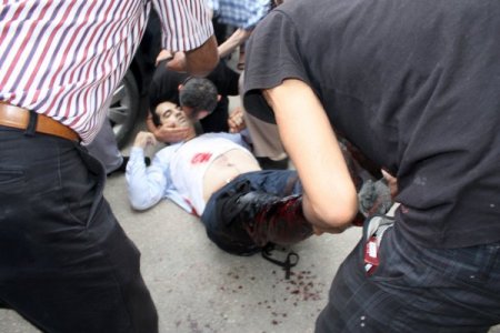 Kastamonu’da Silahlı Yaralama (1)