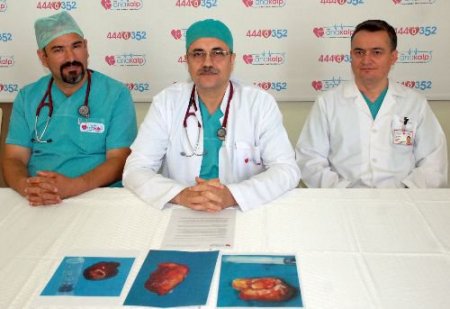 Kayseri'de 3 Hastanın Kalbinden 200'er Gram Tümör Çıkartıldı