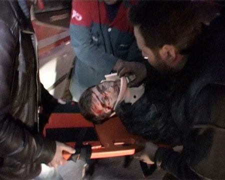 Kepçe otomobili biçti: 2 yaralı