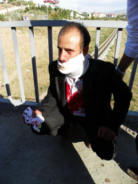 Kırıkkale'de trafik kazası: 6 yaralı