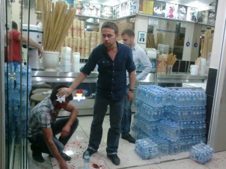 Kız meselesinden çıkan kavgada baltalar konuştu