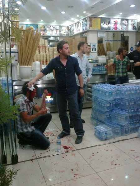 Kız meselesinden çıkan kavgada baltalar konuştu