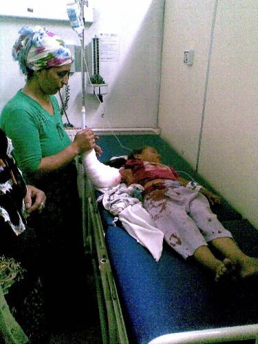 Kolunu Patoza Kaptıran Çocuk Ağır Yaralandı