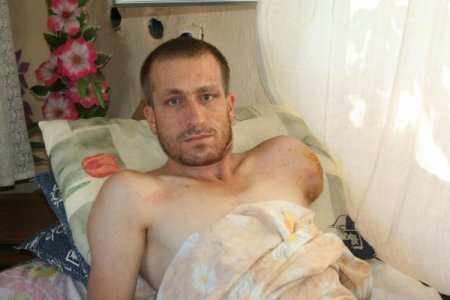 Kolunun İhmaller Nedeniyle Dikilemediğini Öne Süren Genç, Davaya Hazırlanıyor