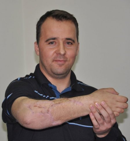 Kopan kolunu diken doktorlarıyla tokalaştı