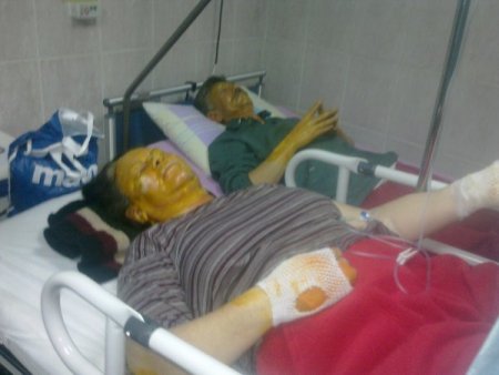 Kozan’da tüpten sızan gaz patlamaya neden oldu: 2 yaralı