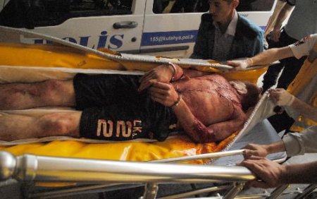 Kütahya'da Bir Asker Kendini Jiletledi