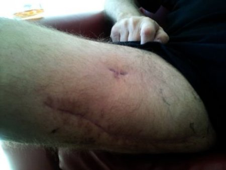 Levent Ersöz'ün Kızı, Babasının Hastanedeki Fotoğraflarını Basına Dağıttı