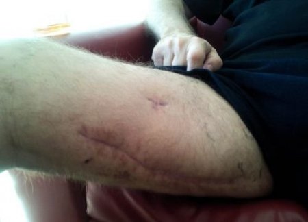 Levent Ersöz'ün Kızı, Babasının Hastanedeki Fotoğraflarını Basına Dağıttı