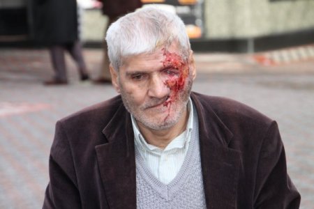 Maganda kurşunu ile hayatı karardı, yüz nakli için yardım bekliyor