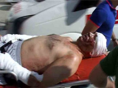 Mersin’de Otele Piknik Tüpüne Sarılmış Bombalı Saldırı