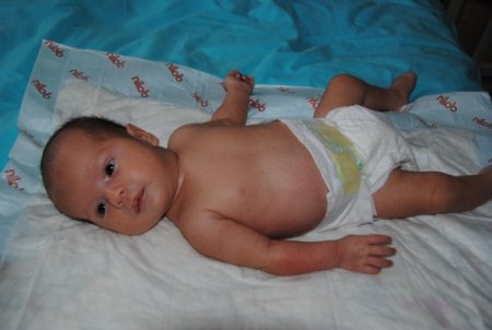 Mevsim değişikliliğine bağlı ısı farklılığı bebekleri hasta ediyor