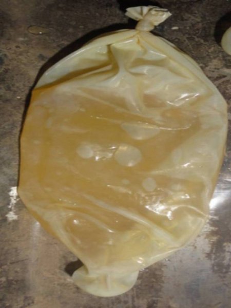 Midesinde 1 kilo 125 gram kokain taşıdı