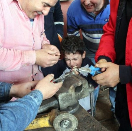 Minik Mustafa’nın parmağı 20 dakikada kurtarıldı