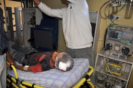 Nusaybin'de Taş Atan Grup Arasında Bulunan 12 Yaşındaki Çocuk Yaralandı