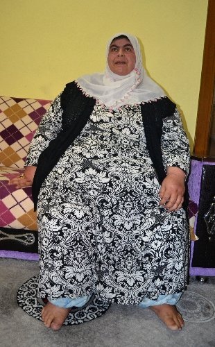 Obezite hastası kadın, 7 ayda 64 kilo verdi