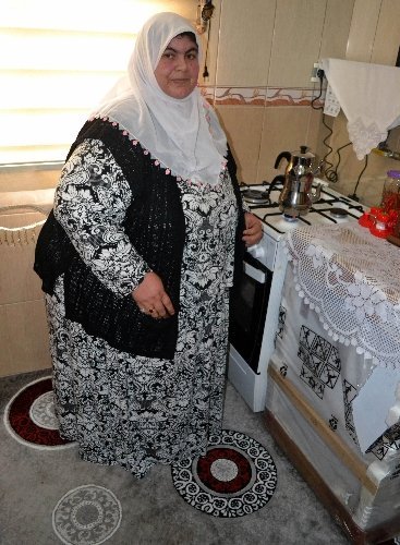 Obezite hastası kadın, 7 ayda 64 kilo verdi