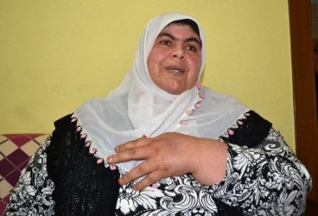 Obezite hastası kadın, 7 ayda 64 kilo verdi