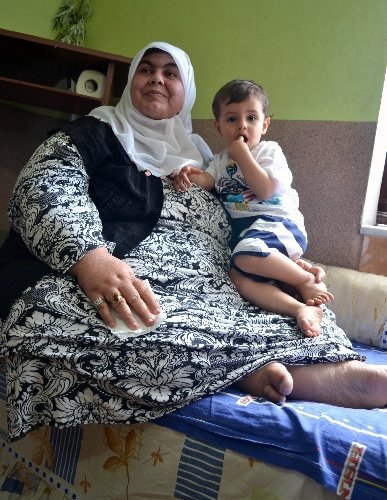 Obezite hastası kadın, 7 ayda 64 kilo verdi