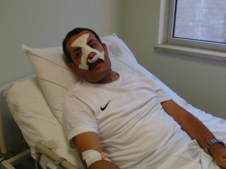 Öğrenci velisi, okul idarecisinin burnunu kırdı