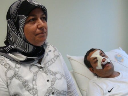 Öğrenci velisi, okul idarecisinin burnunu kırdı